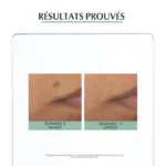 EUCERIN DERMOPURE TRIPLE ACTION SERUM – Image 5